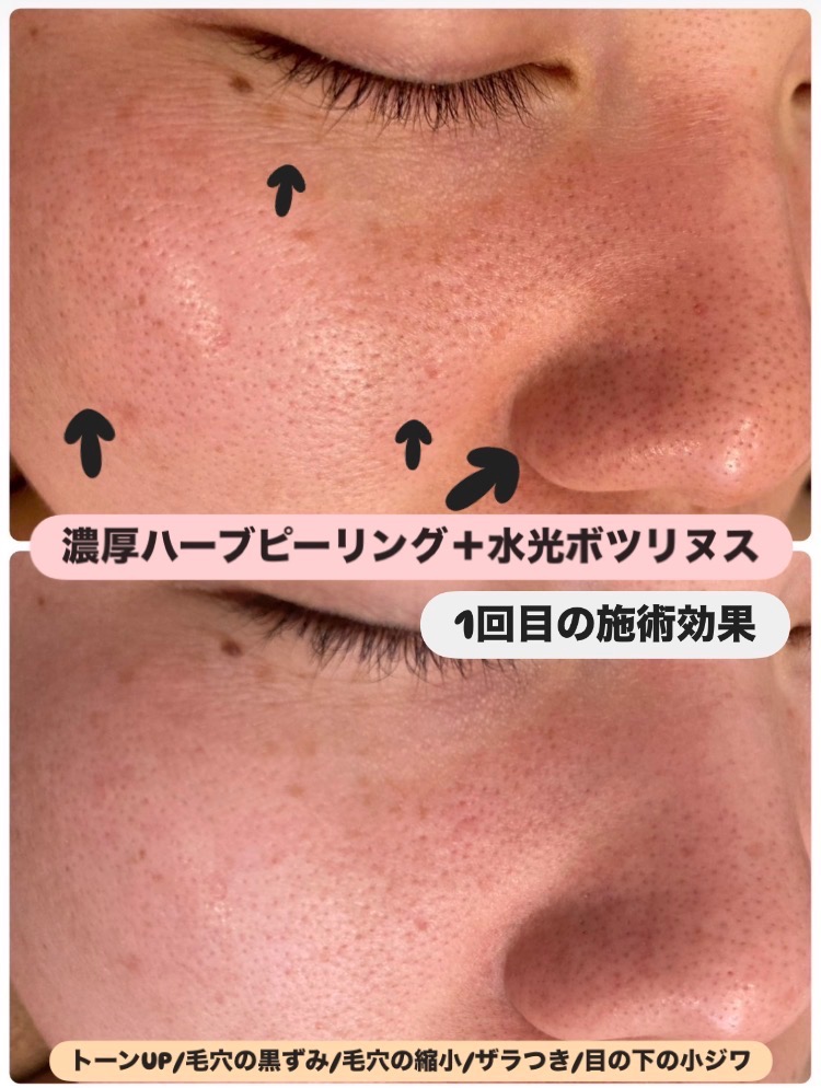 1回の効果が凄い◎様々な箇所が変わる‼️