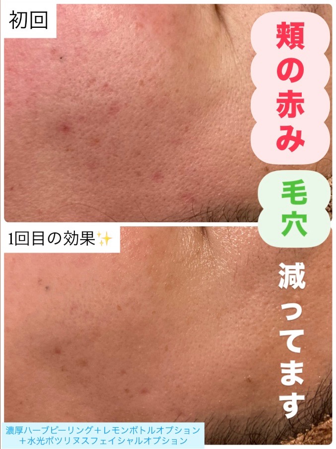 1回目の効果で...✨