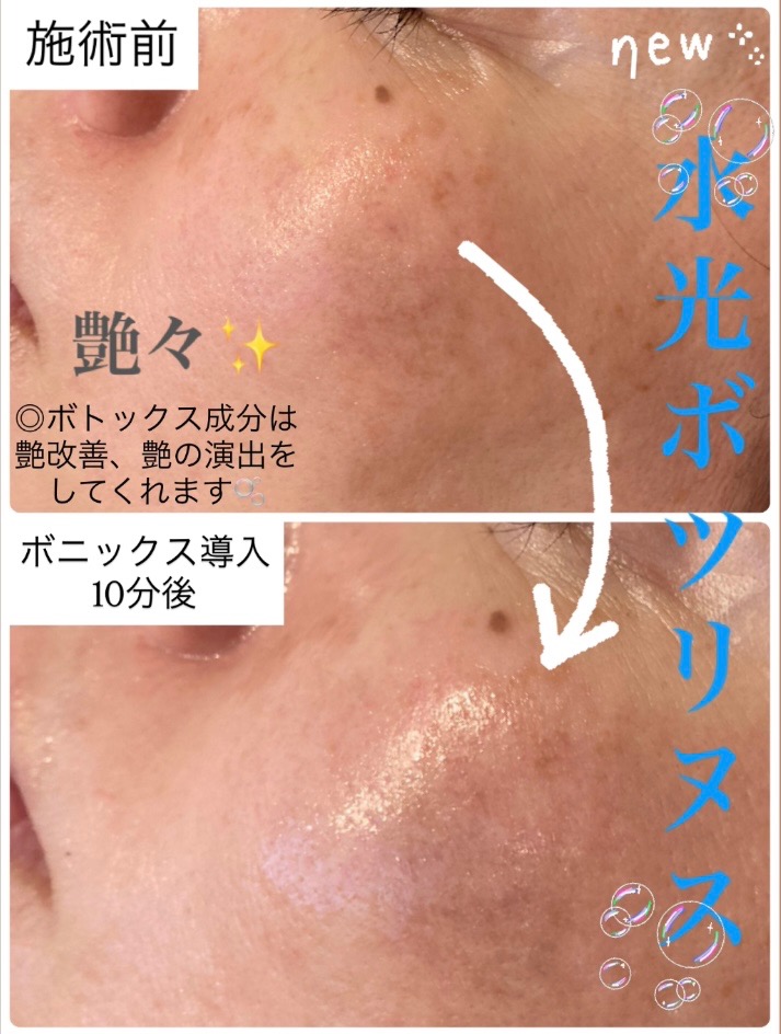 ボニックス美容液を導入しただけで...