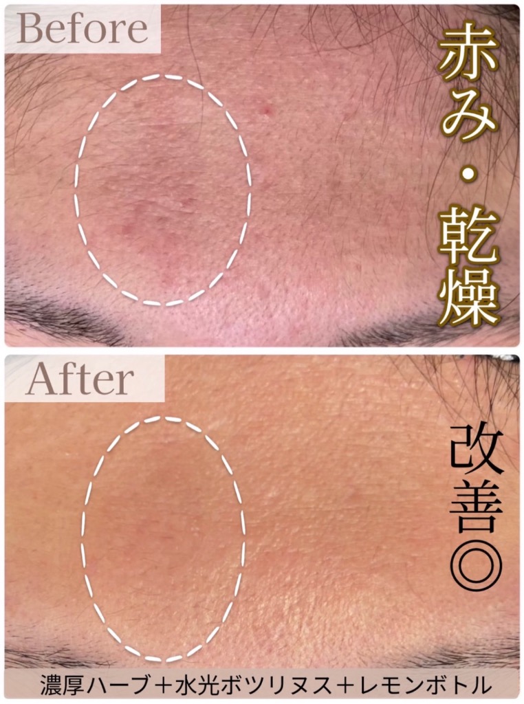 乾燥が気になる方でも◎