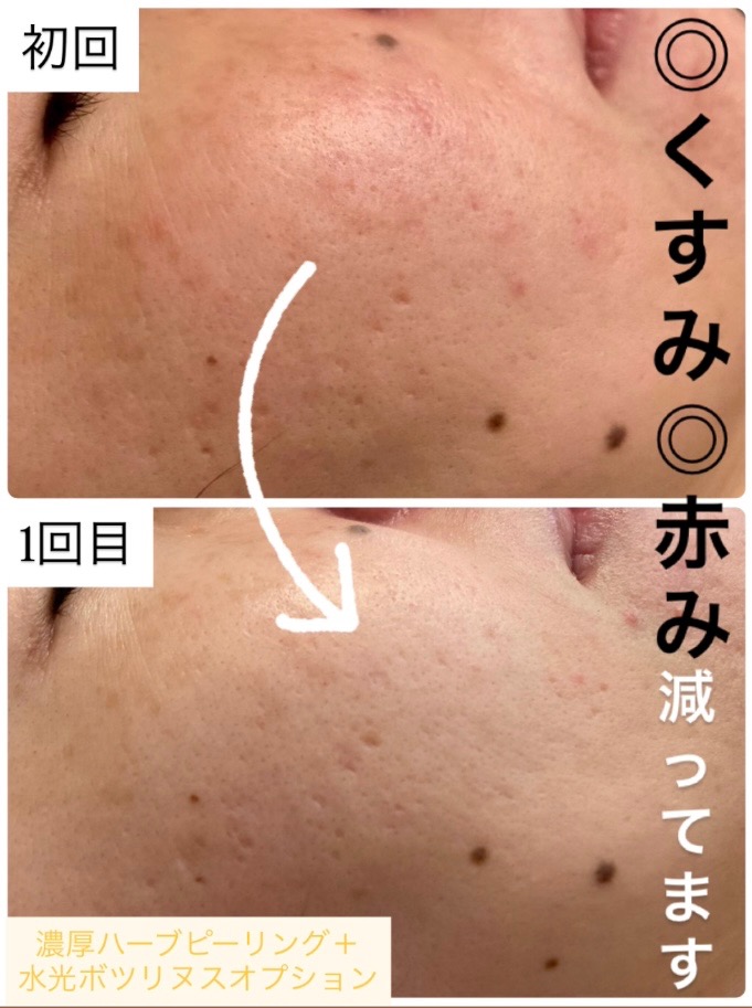 1回目の効果で...😳✨