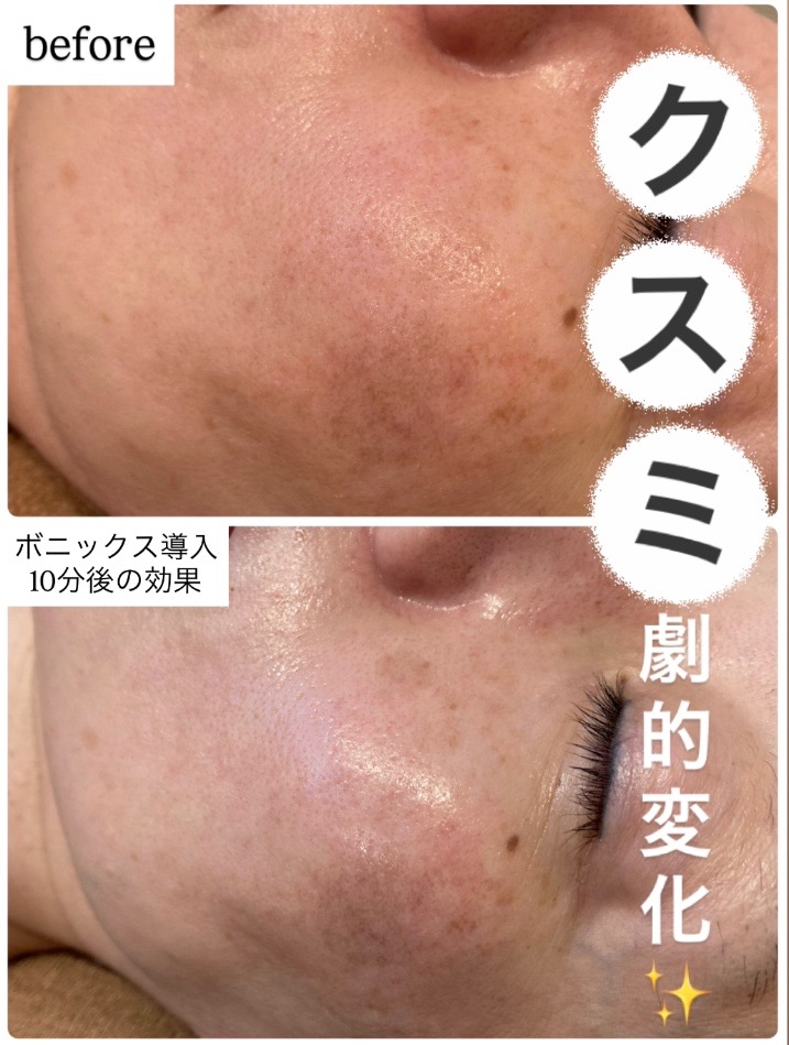 お肌トーンUPしてます🫧