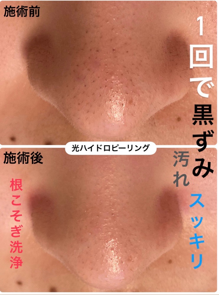 1回で汚れスッキリ(^^)