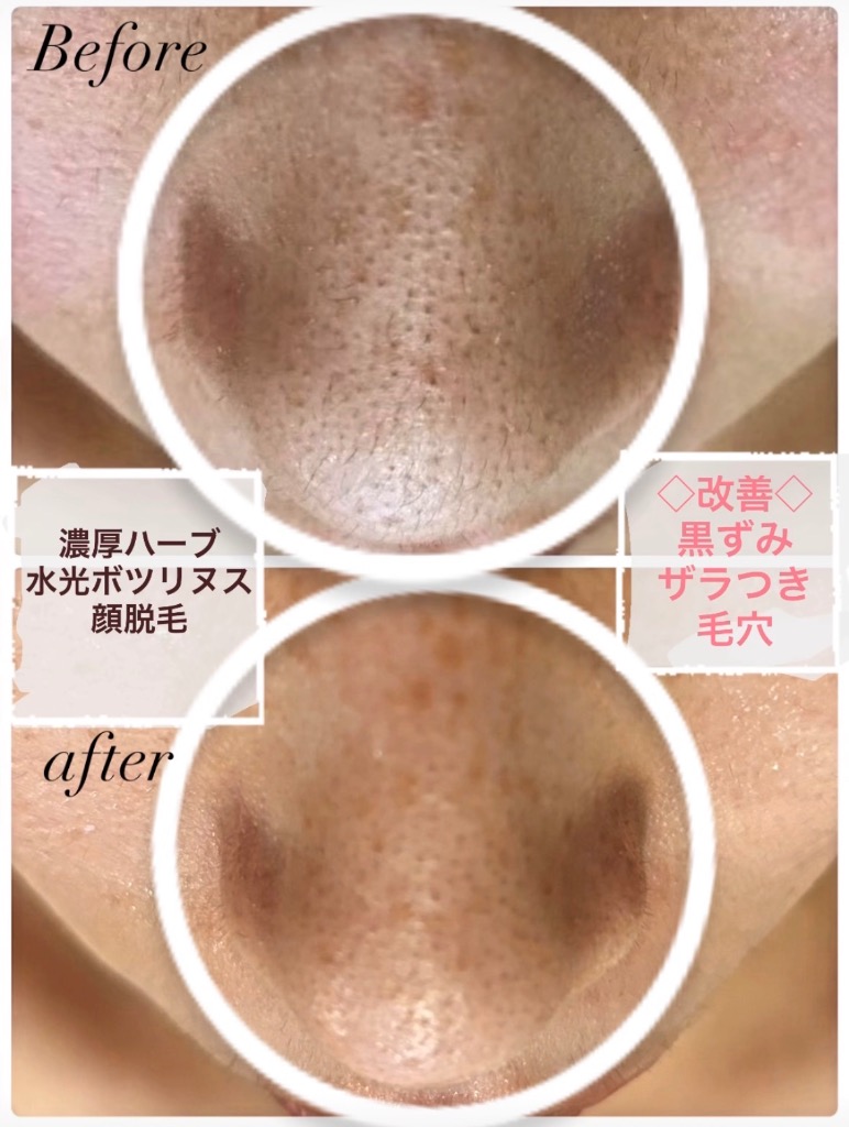 施術を重ねる度にキレイになられてます(*^▽^*)