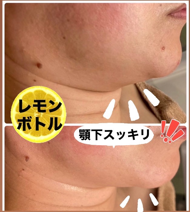 寝ている間に顔痩せ出来ちゃいます◎