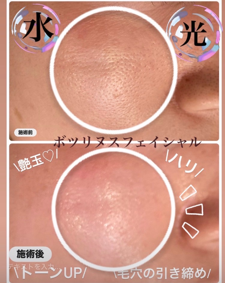 施術前後の効果✨