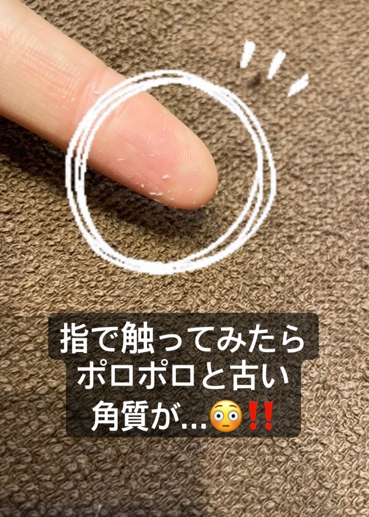 光×ハイドロピーリングの施術例