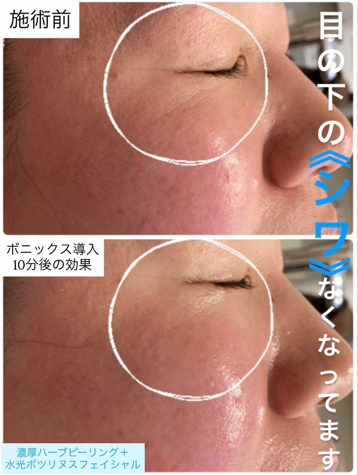 目の下のシワなくなってます😳