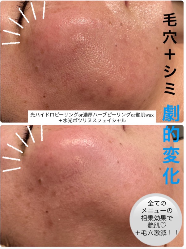 他のメニューと合わせる事で効果アップ(^^)